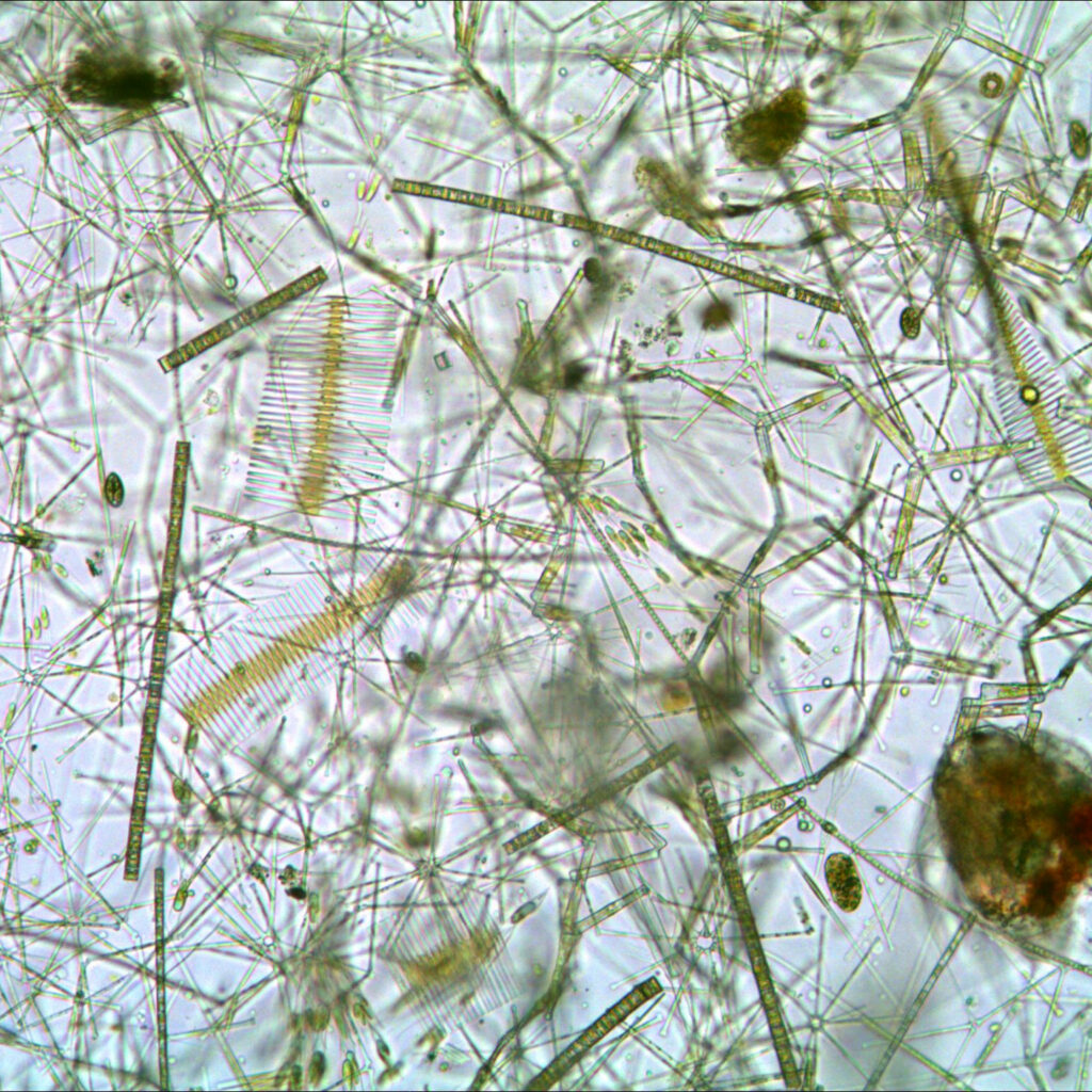 Dense diatom growth observed in a periphyton sample under inverted microscopy. Fragillaria, Asterionella, Aulacoseira, and other freshwater algae.
